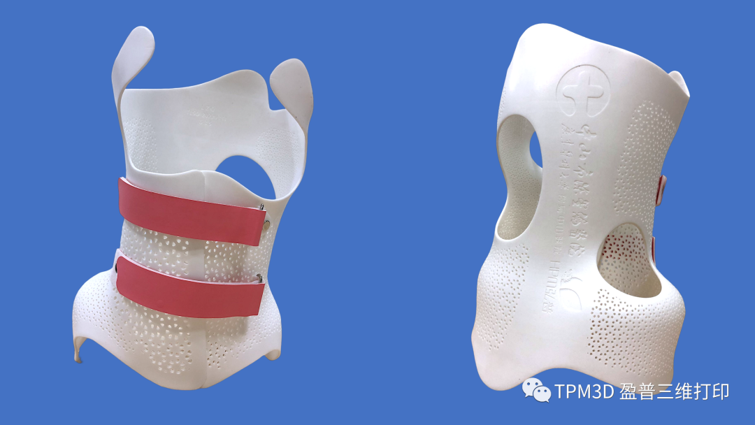 盈普SLS 3D打印脊柱侧弯矫形器